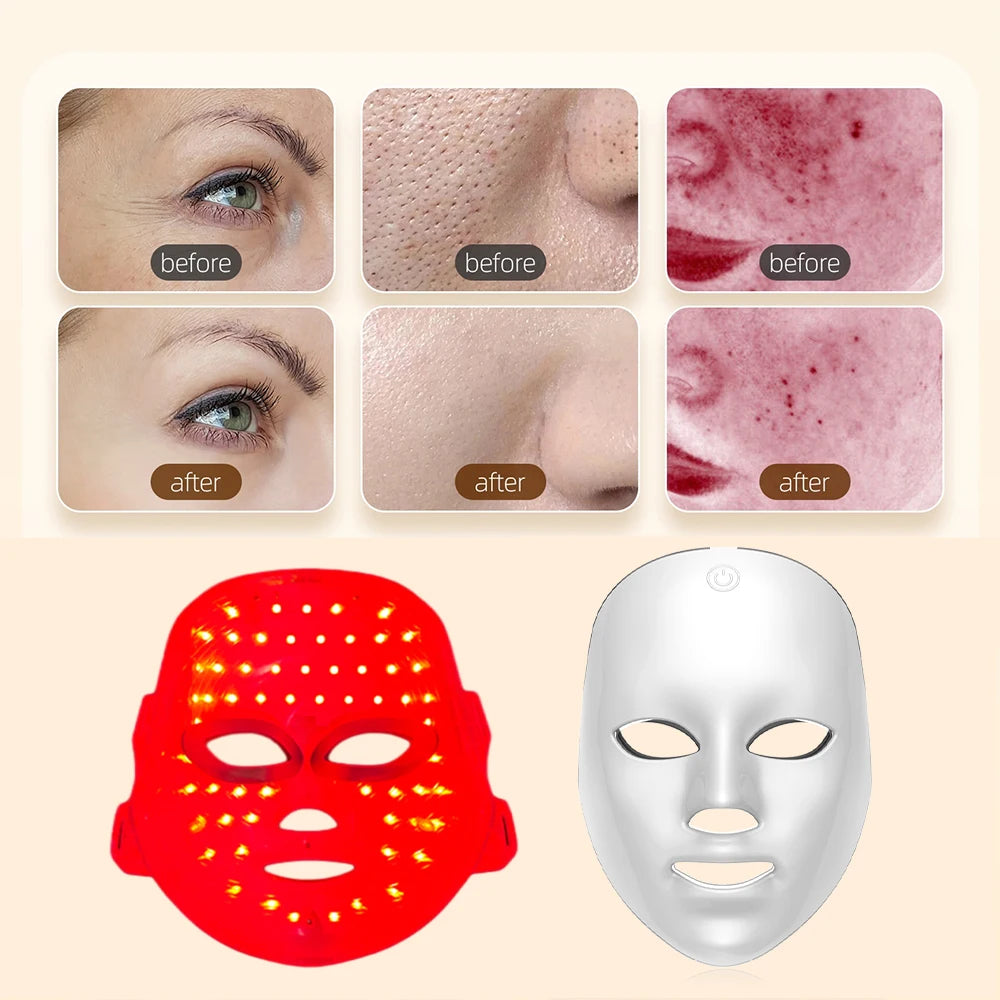 LuminaGlow – Máscara LED Facial de Fototerapia Pro