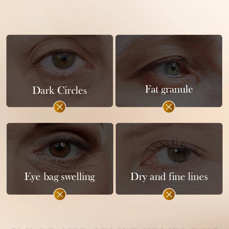 Crema Contorno de Ojos SADOER con Péptidos de Veneno de Serpiente – Antiarrugas y Antiojeras